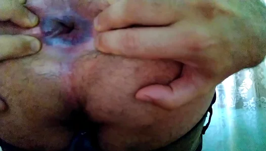 Tight Young Lover Buries Himself On Huge Cock – Intense Gay Anal Action – Amateurs 18+